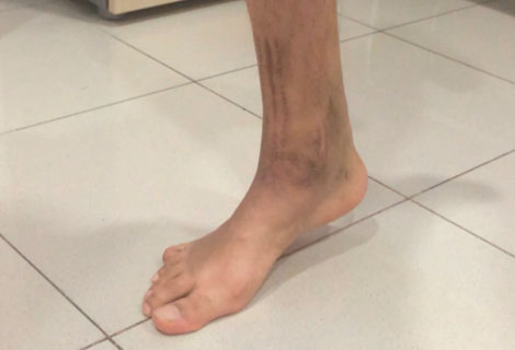 Detener el dolor de la ciática con yoga
